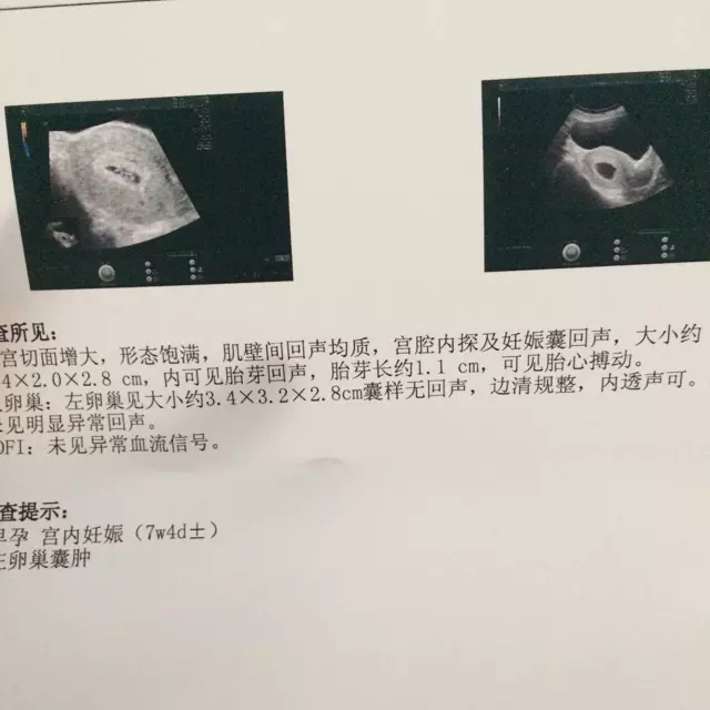 1、怀男孩很早就有感觉:怀男孩子的时候会有什么感觉？