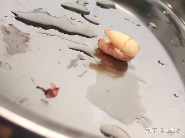 1、长智齿预示着什么运势:长智齿预示未来好吗