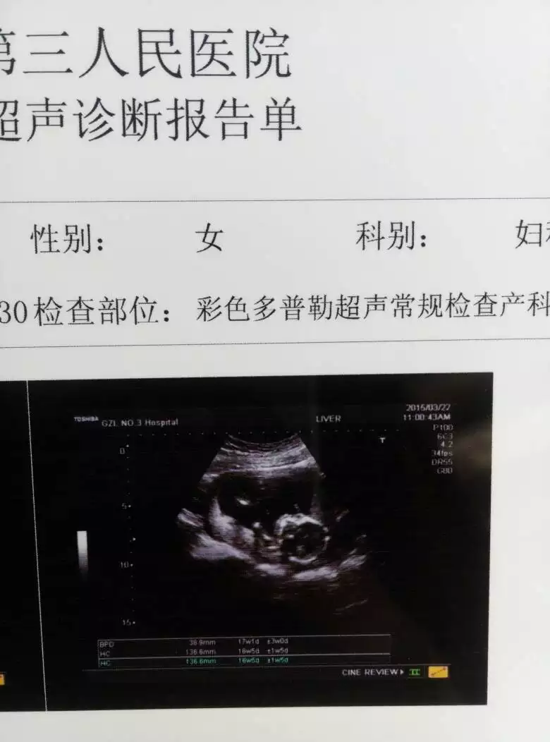 4、年兔年生男孩多還是女孩多:為什麼近十年來生男孩比生女孩多