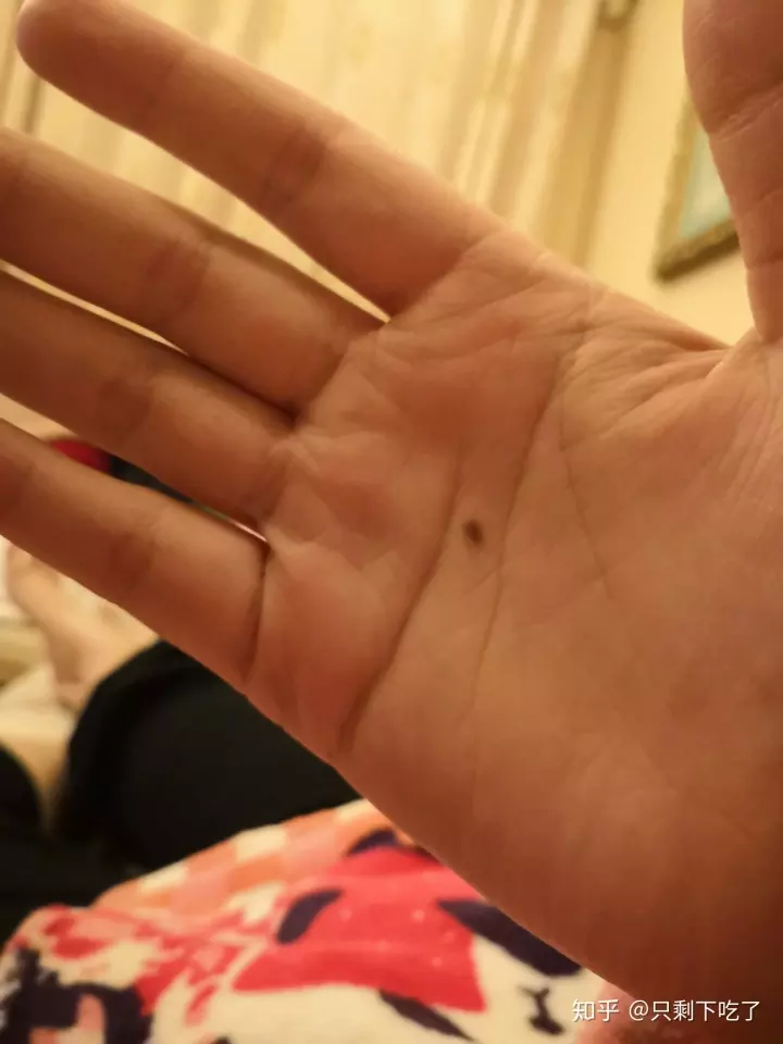 3、聽人說:在愛里被辜負的人+左手就會長痣+右手是辜負了**的人.是真的假的？
