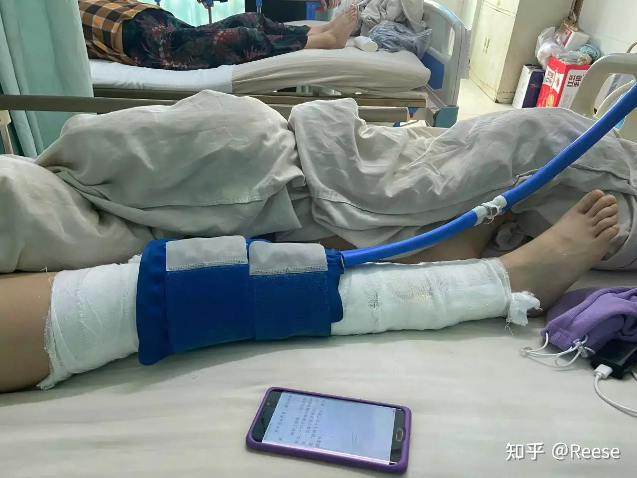 2、15天逼走滑滑膜炎的方法:滑膜炎用什麼方法****？