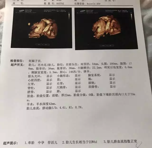 2、四維看男孩女孩訣竅:四維數值辨別男孩女孩