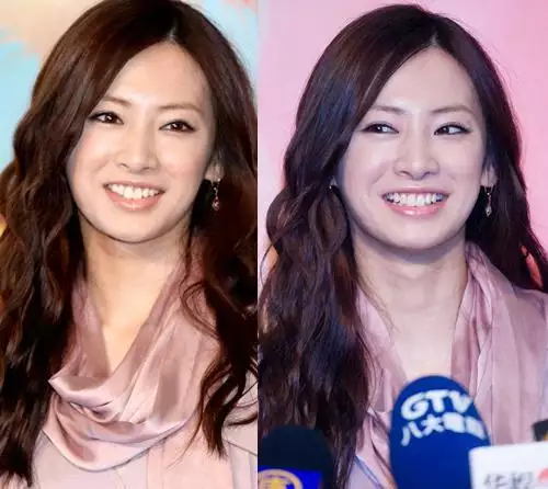 从眼角到脸颊的八字纹：怎样去除脸部八字纹？