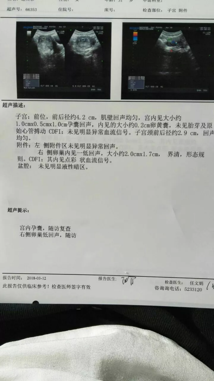 3、孕囊中間数字小是兒子:孕囊形狀是長形的還是圓形的？