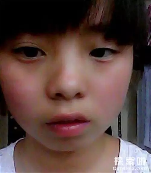 2、什么阳眼:眼是什么?什么人才会有?