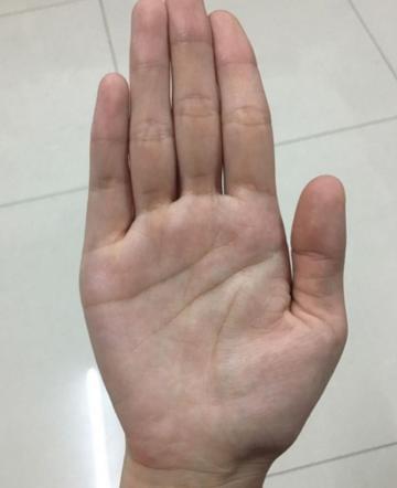 4、婚姻线三条:我有三条婚姻线 什么情况