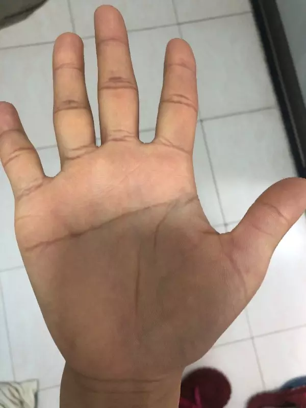 4、女人右手有**離婚紋:我的手相是**離婚線肯定會離婚嗎