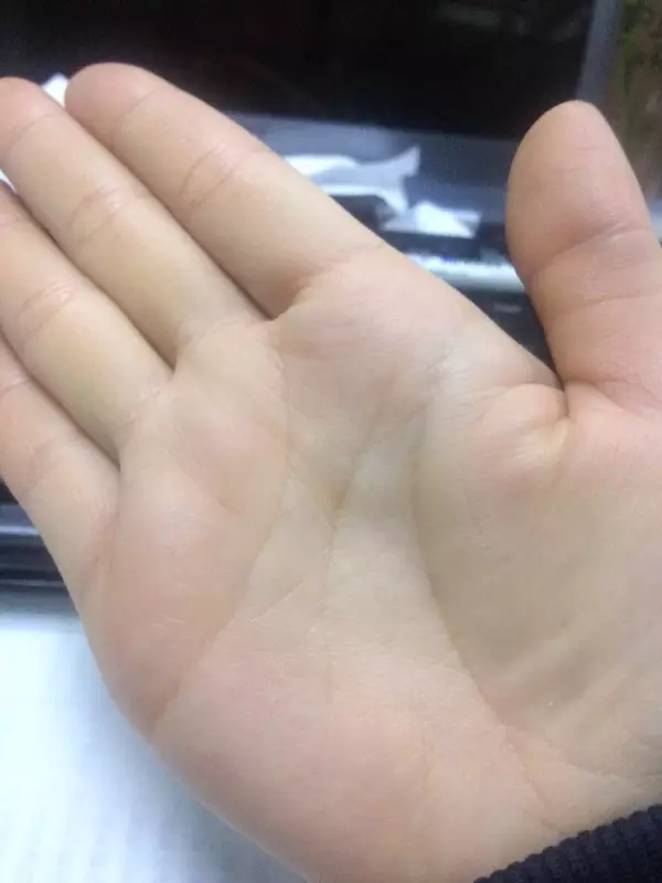 2、雙手川字紋的女人罕見嗎:我是女生，雙手都是川字紋