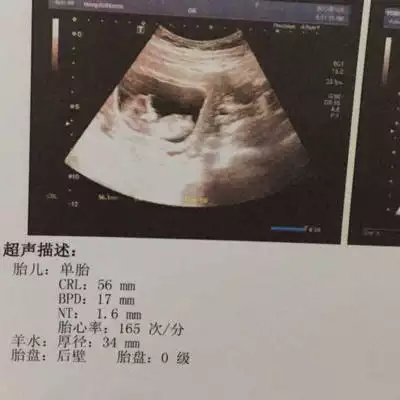 2、懷男孩很早就有感覺初期:懷男孩的初期反應