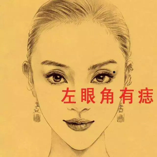 4、开眼角影响运势吗:为什么割双眼皮开眼角会影响老公运气呢!