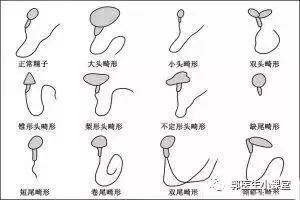 1、生儿子一定要在排卵前还是后:备孕二胎想要个儿子应该怎么准备好?