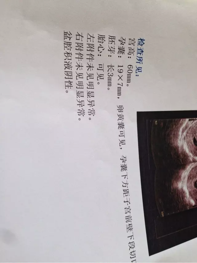 九个最准怀男孩征兆：怀男孩的征兆