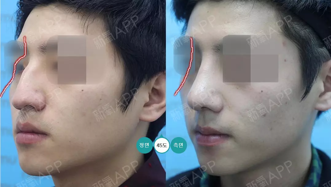 1、鹰钩鼻的男人的运势:鹰钩鼻的男人好不好相处呢？