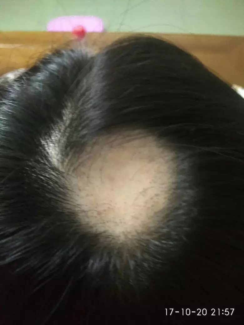 3、懷男孩看頭髮最准:懷兒子的特徵最準的：