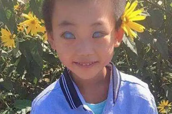 1、有没有人有眼:世界上真的有人有眼吗？有科学依据吗？