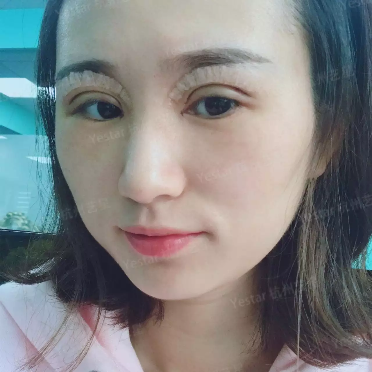 4、做双眼皮影响运势:割双眼皮 会不会影响运势 目前本人运势不佳