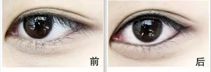 1、纹眼线会影响运势吗:纹眼线注意事项？纹眼线后几天能好？