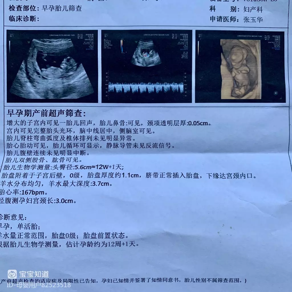 3、懷孕12周的NT圖，看着孩子肚子好大，附圖，順便看看是男女？謝謝
