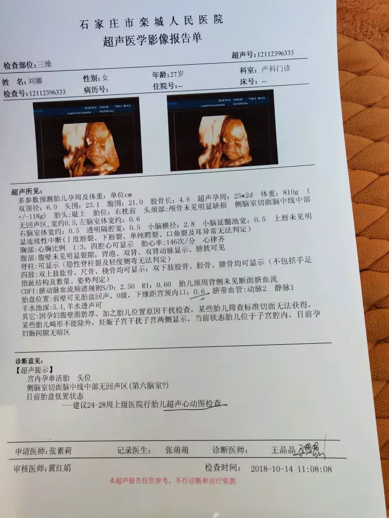 上一胎预知下一胎男女：梦幻手游小兜妹怎么样
