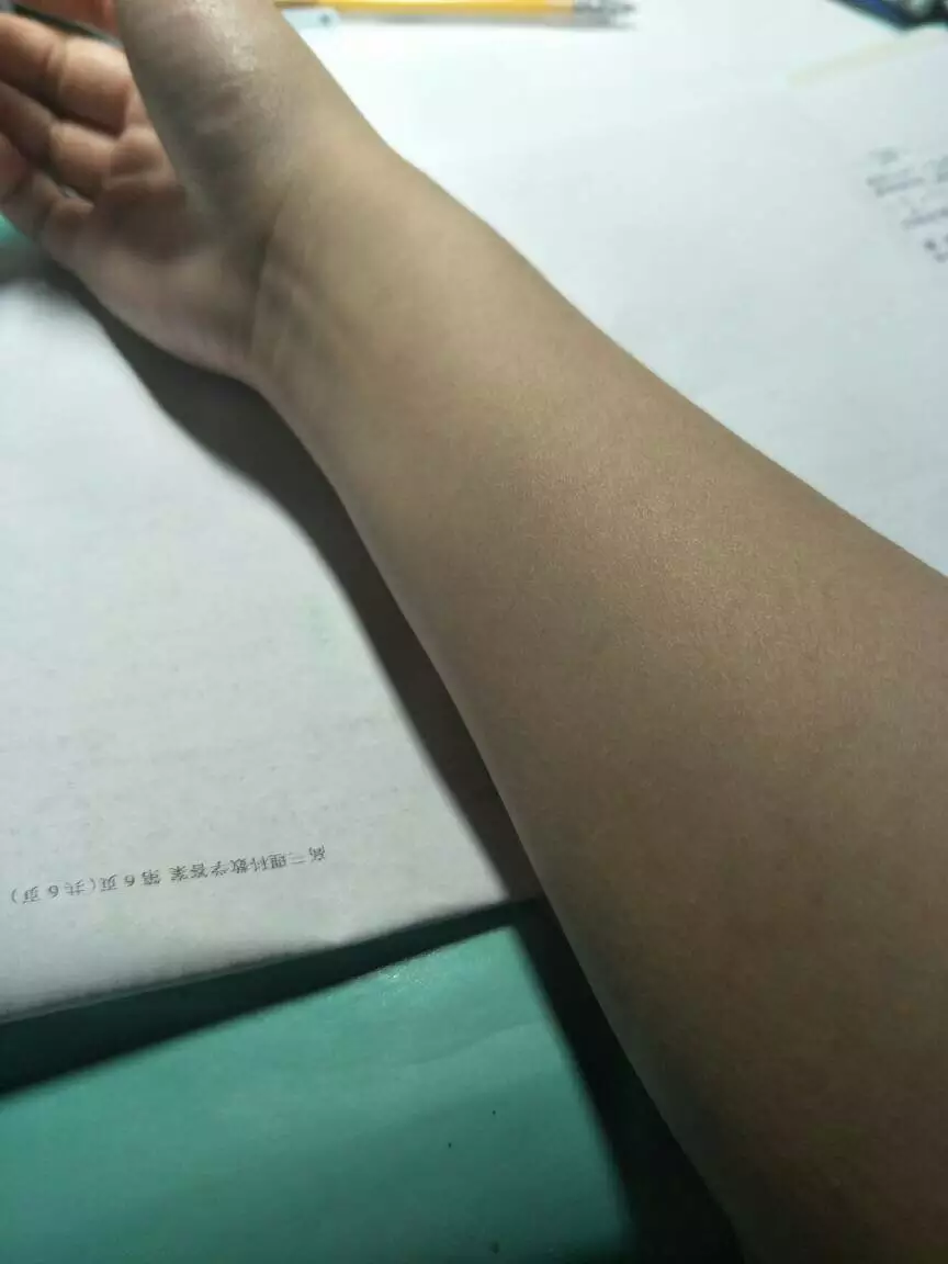 2、左胳膊疼可能是1種重病徵兆:左胳膊有點疼？