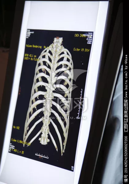 胸骨正下方八字口处疼痛