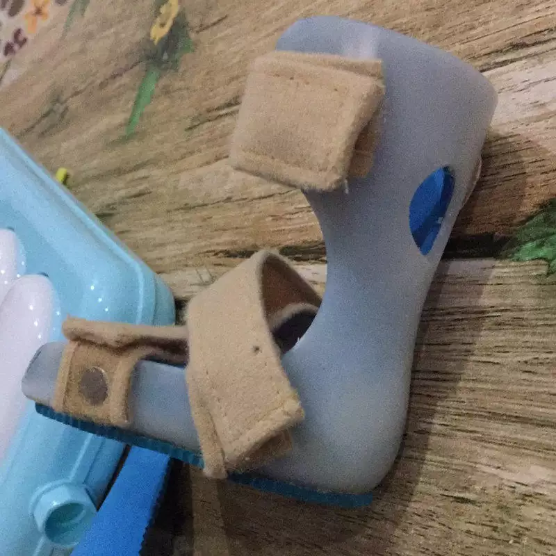 小孩八字脚该怎样纠正:很想知道小孩子外八字脚怎么矫正,拇外翻最佳治疗方法是什么?