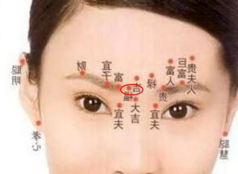 2、脸上有痣影响运势吗:脸上的痣真的能影响一个人的运气吗？