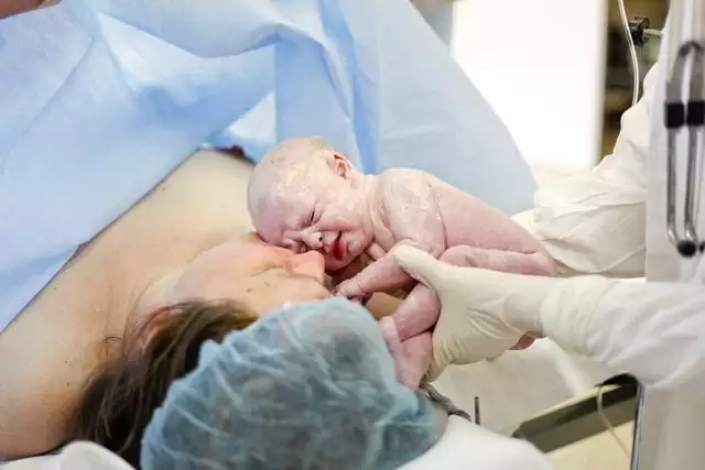 剖腹产要不要挑时辰，女孩剖腹产选什么时辰