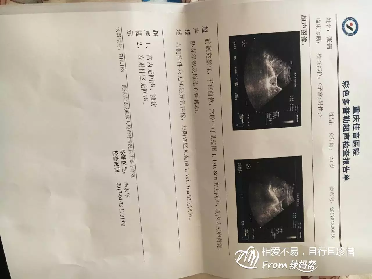 年几月份生男孩：年是什么生肖年生男生女