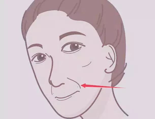 鼻子两边有八字纹：女人印堂有八字纹好吗