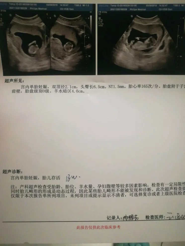 1、10秒测出怀男孩和女孩:怎样测出怀男孩和女孩