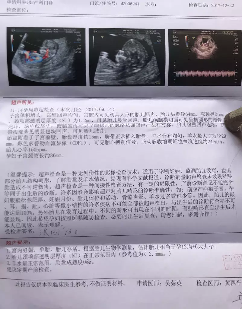 2、孕12周nt暗示男女:12周了照的Nt 大家幫忙看看男孩女孩