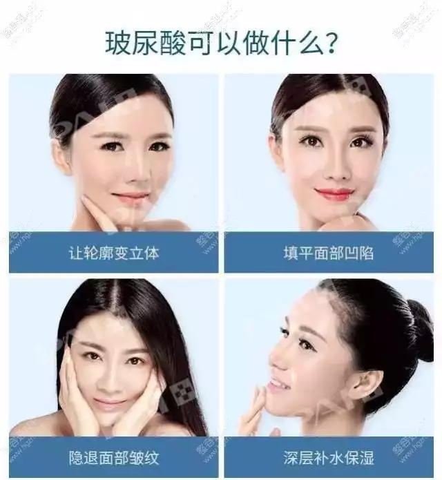 从眼角到脸颊的八字纹：脸上的八字纹有什么办法改善吗？