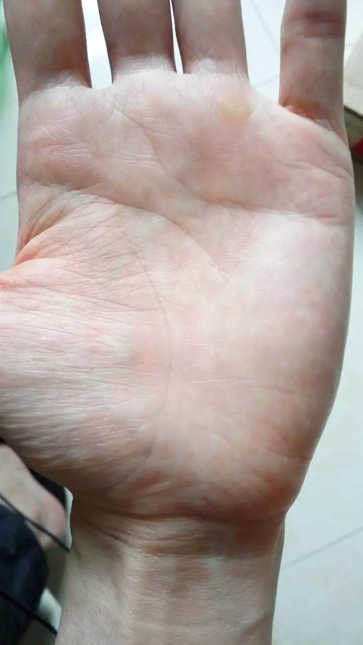 2、愛情線是哪條在手上是哪條線?:愛情線是哪一條線?