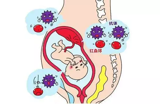4、為什麼醫生最怕o型血孕婦:o型血的人有什麼好處和壞處