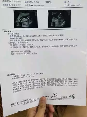 2、NT單子男孩有圈圈:nt胎心是男孩還是女孩