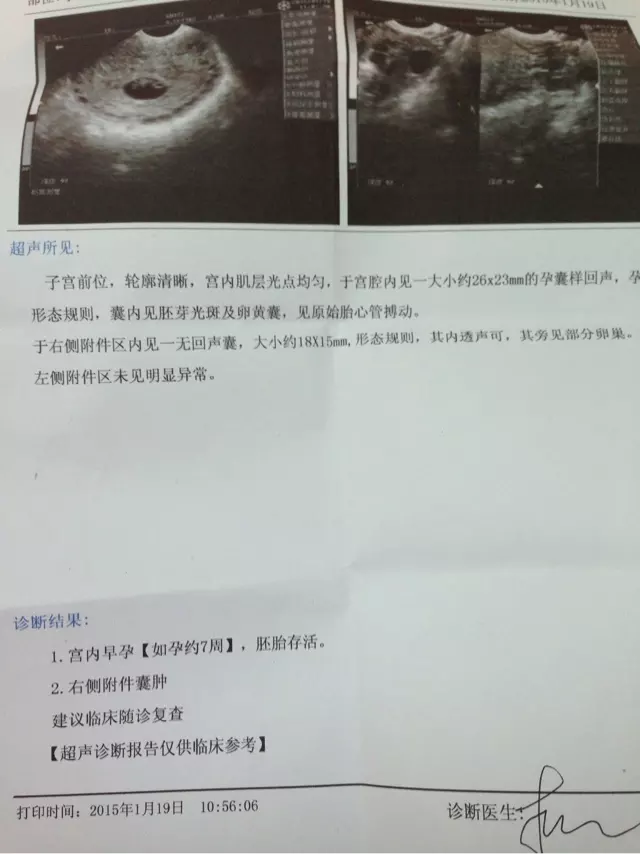 1、其实看孕囊很准:孕囊看男女，非常的准，只是你不会看（教你怎么看）