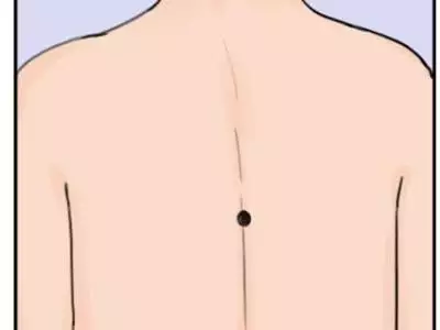 3、女人後背痣的位置與命運圖解:女人後背痣的位置與命運圖解