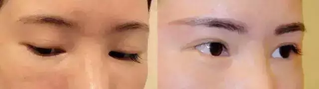 2、眉峰做了会影响运势吗:眉毛真的能影响人的运气吗？