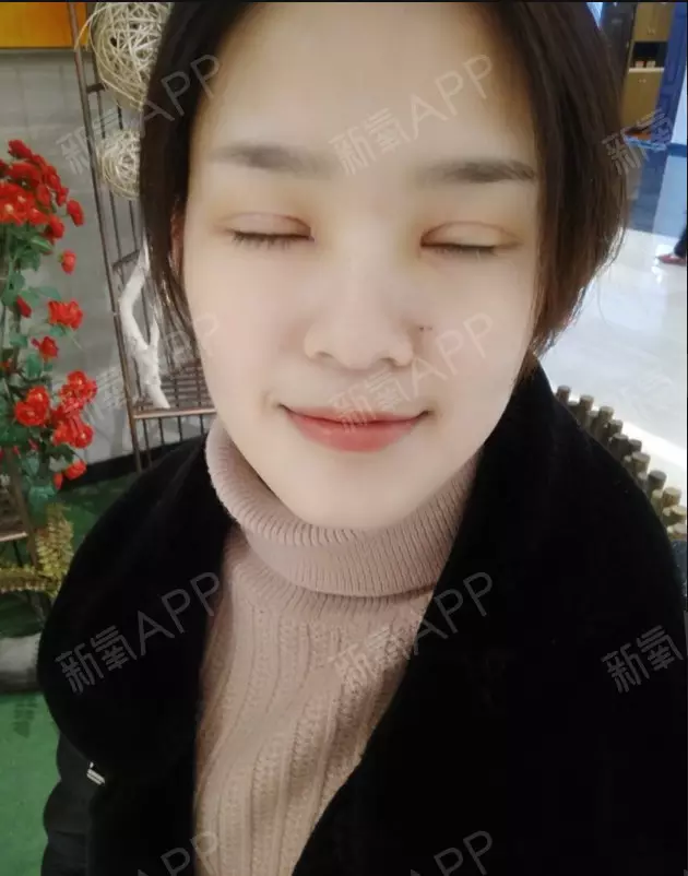 5、开眼角影响运势吗:男人开眼角对风水好不好？