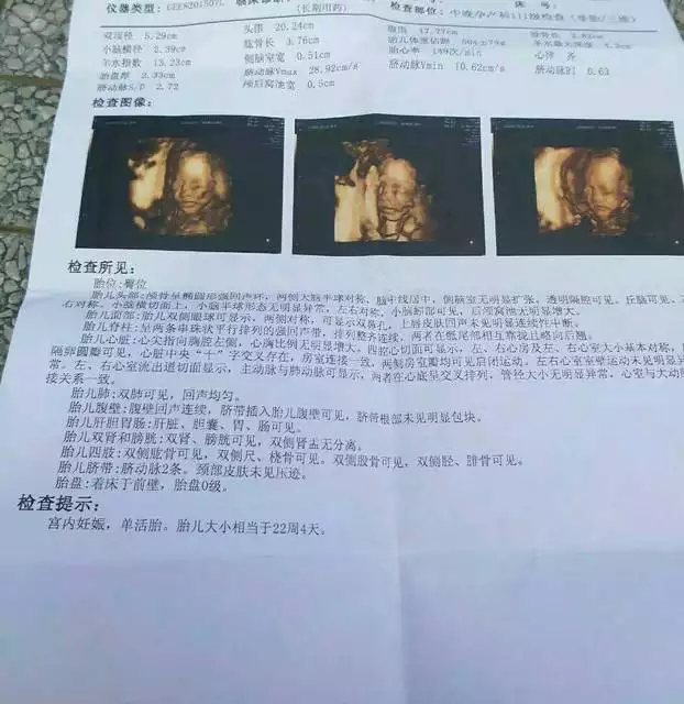 上一胎预知下一胎男女：第一胎是儿子在儿上怎么能看出第二胎生男女