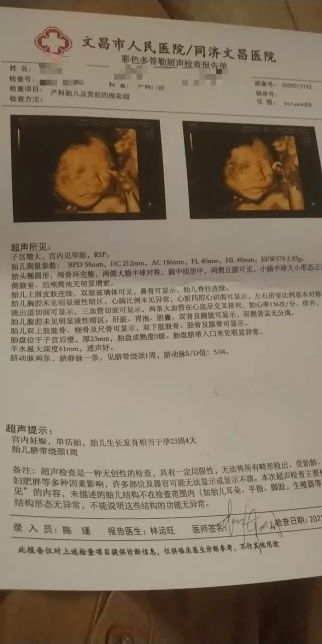 3、四維看男孩女孩訣竅:剛拍得四維，怎麼看男女啊？