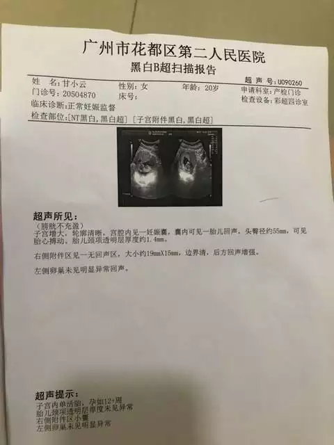 4、NT單子男孩有圈圈:NT圖誰會看男女