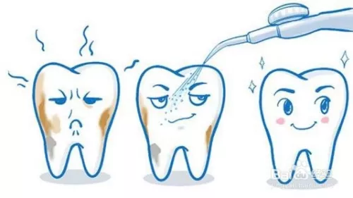 3、洗牙对运势有帮助吗:洗牙化解在运势里是什么意思?