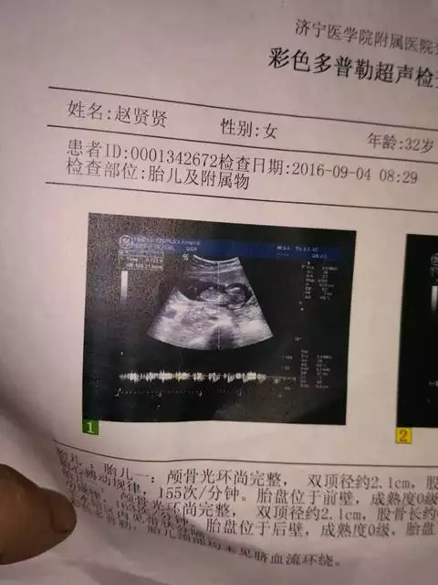 6、怎么知道自己有没有怀孕:怎么样才能知道自己的破没有呢