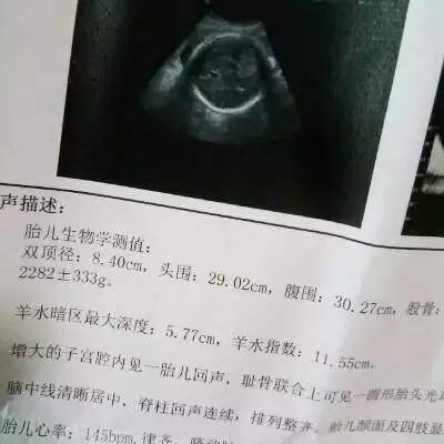 2、10秒测出怀男孩和女孩:怎么判断自己怀的是男孩还是女孩?