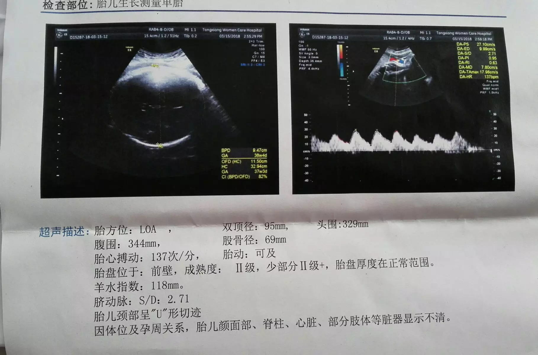 3、妈妈能和孩子同属相同月同日吗:儿子跟妈妈是同样的属相命运会怎么样?