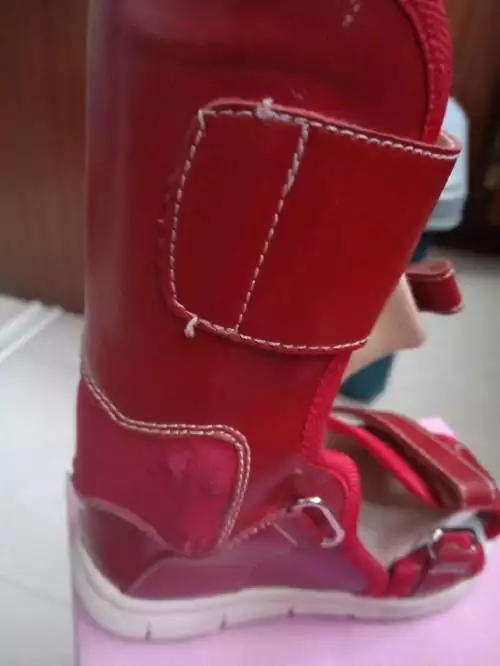 走路内八字怎么矫正：小孩子走路内八字的话怎么样才能矫正过来