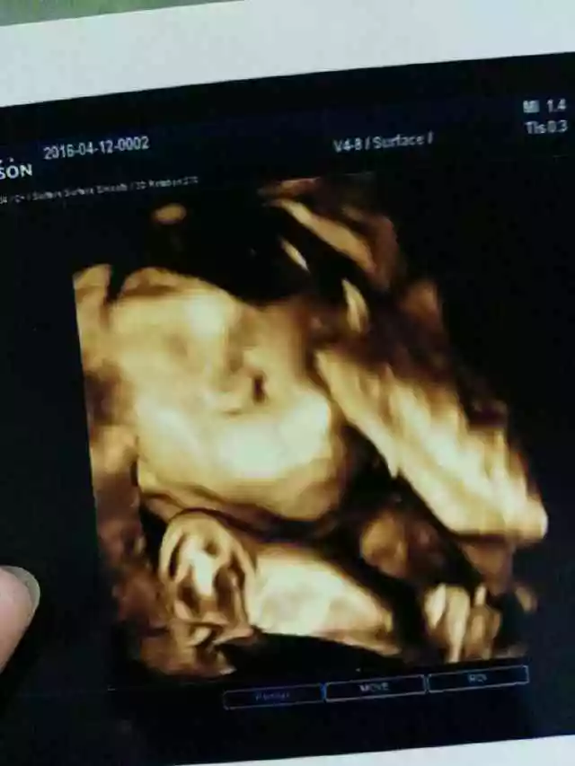 3、孕期徵兆暗示你生男孩!:孕婦哪些徵兆是生男孩