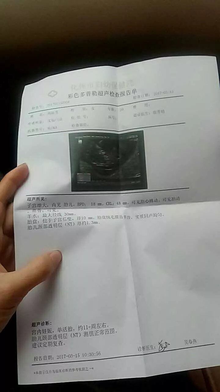3、年兔年生男孩多還是女孩多:年兔寶寶好不好